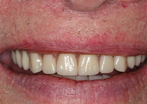 dental implants ashford|Ashford, Kent – Oradent Dental Care.